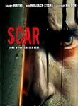 Scar